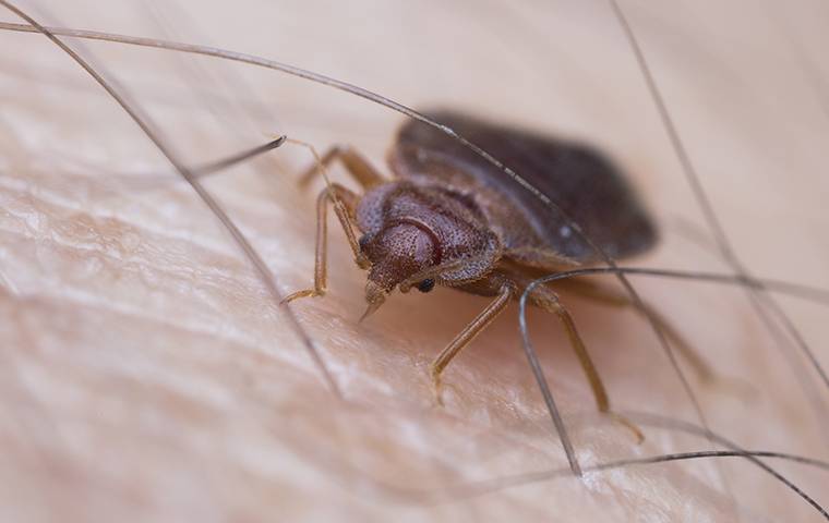 A Bed Bug biting human skin